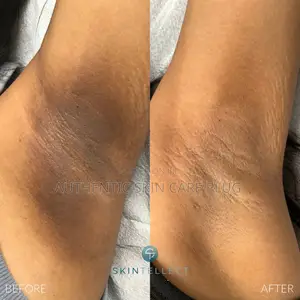 Premium Skin Lightening L-Glutathione Tablets With Alpha Arburtin