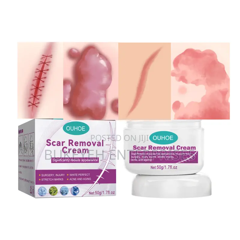 Hot Sale Scar Removing Cream and Repair All Kinds of Old Scars