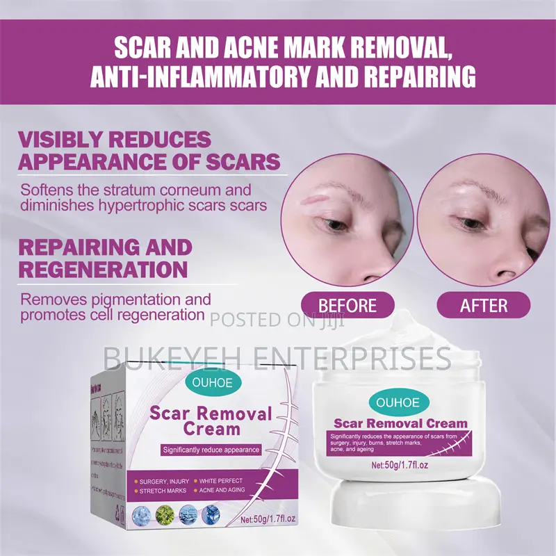 Hot Sale Scar Removing Cream and Repair All Kinds of Old Scars