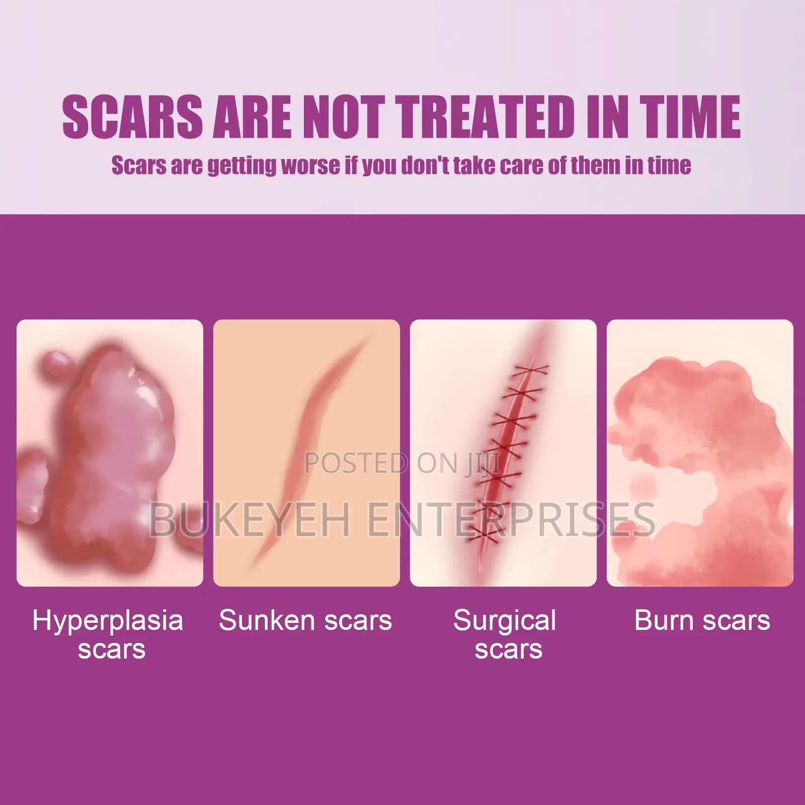 Hot Sale Scar Removing Cream and Repair All Kinds of Old Scars