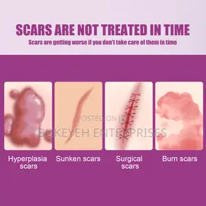 Hot Sale Scar Removing Cream and Repair All Kinds of Old Scars