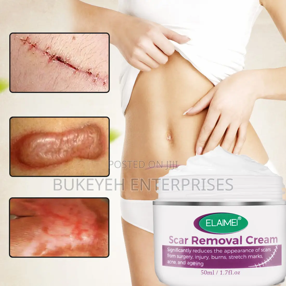 Hot Sale Scar Removing Cream and Repair All Kinds of Old Scars