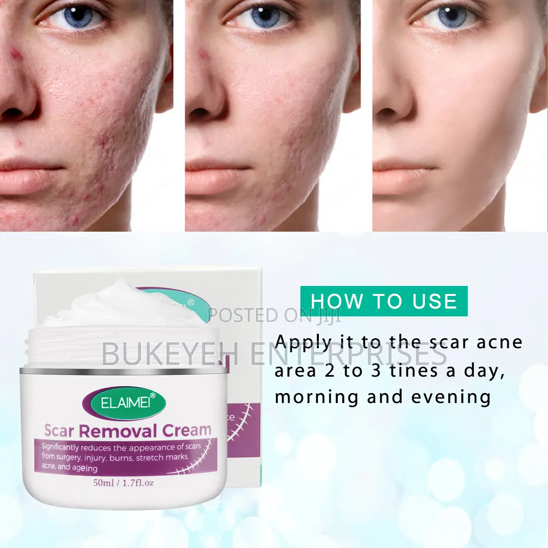 Hot Sale Scar Removing Cream and Repair All Kinds of Old Scars