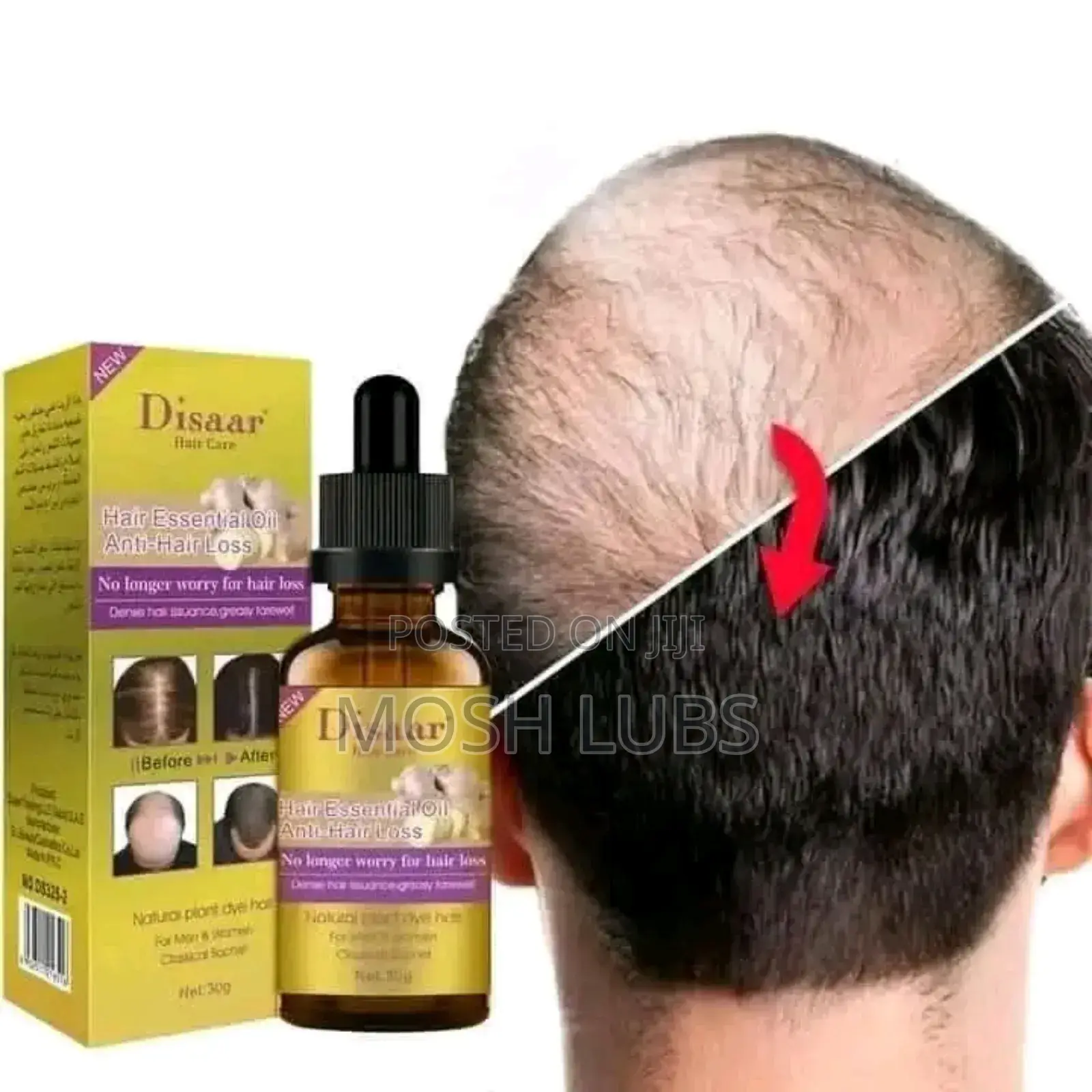 Disaar Essential Hair Growth {Say No to Baldness}
