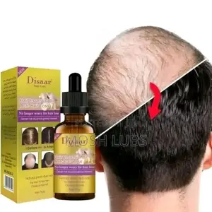 Disaar Essential Hair Growth {Say No to Baldness}