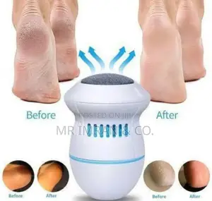 Electric Foot Callus Remover