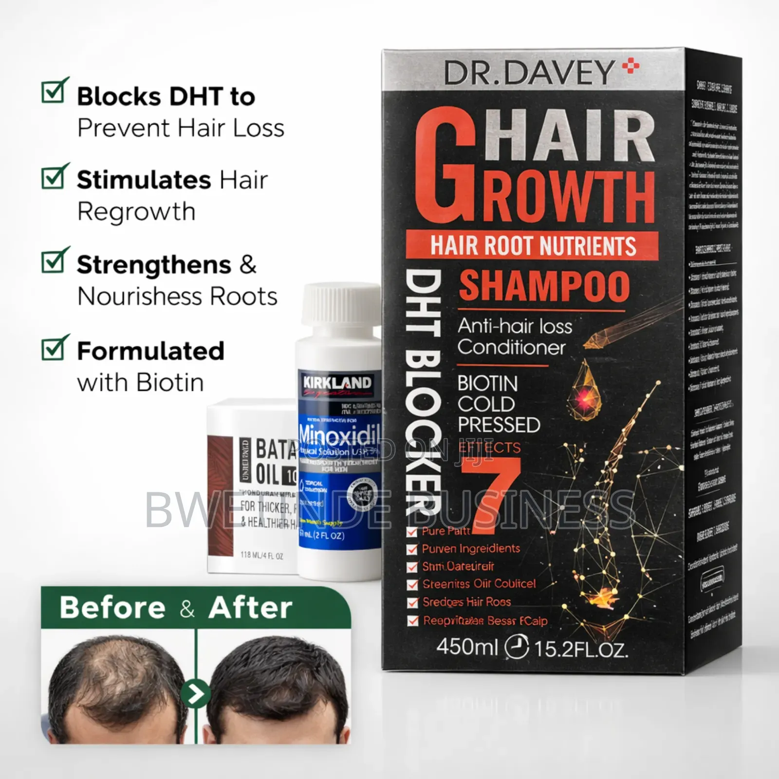 Hair Growth Combo Minoxidil 5% + Batana Oil + DHT Blocker Shampoo