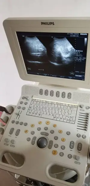 Phillips Hd6 - Color Doppler Ultrasound Scan