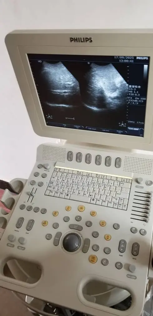 Phillips Hd6 - Color Doppler Ultrasound Scan