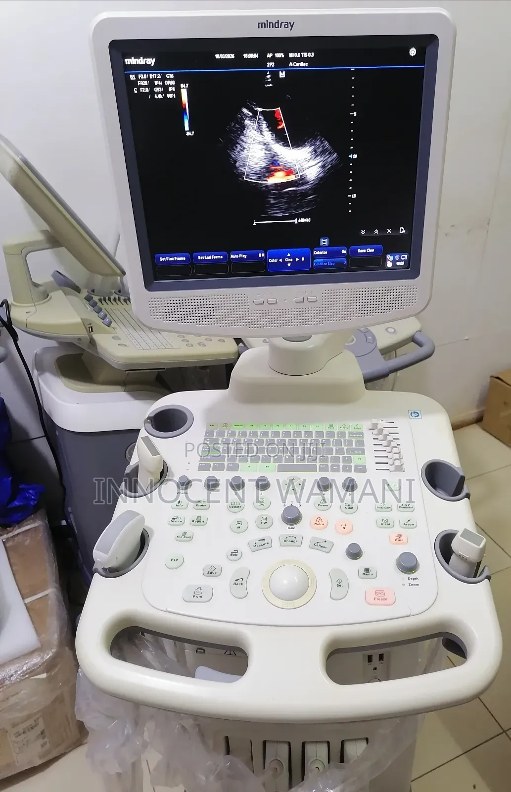 Mindray Dc3t Ultrasound Scan Machine.