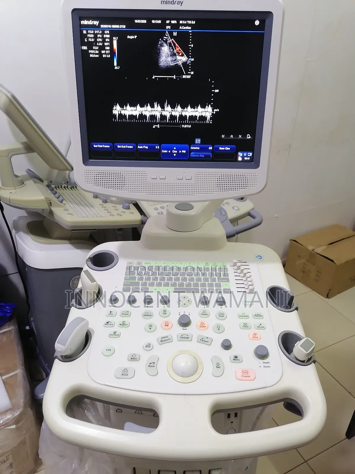 Mindray Dc3t Ultrasound Scan Machine.
