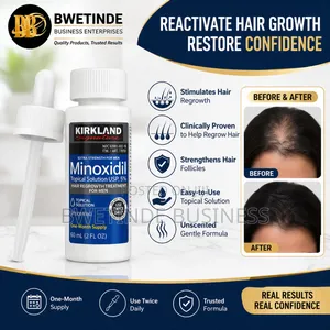 Kirkland Signature Minoxidil 5% Strength Hair Regrowth