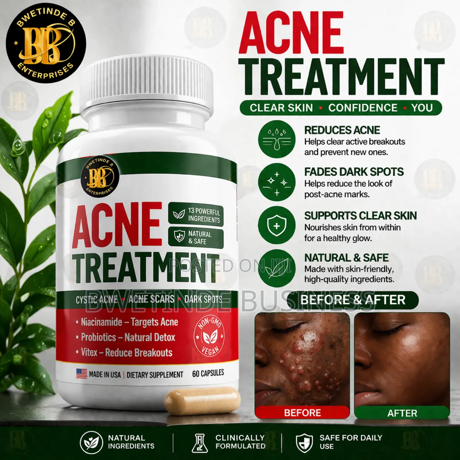 Acne Treatment Capsules Dark Spots