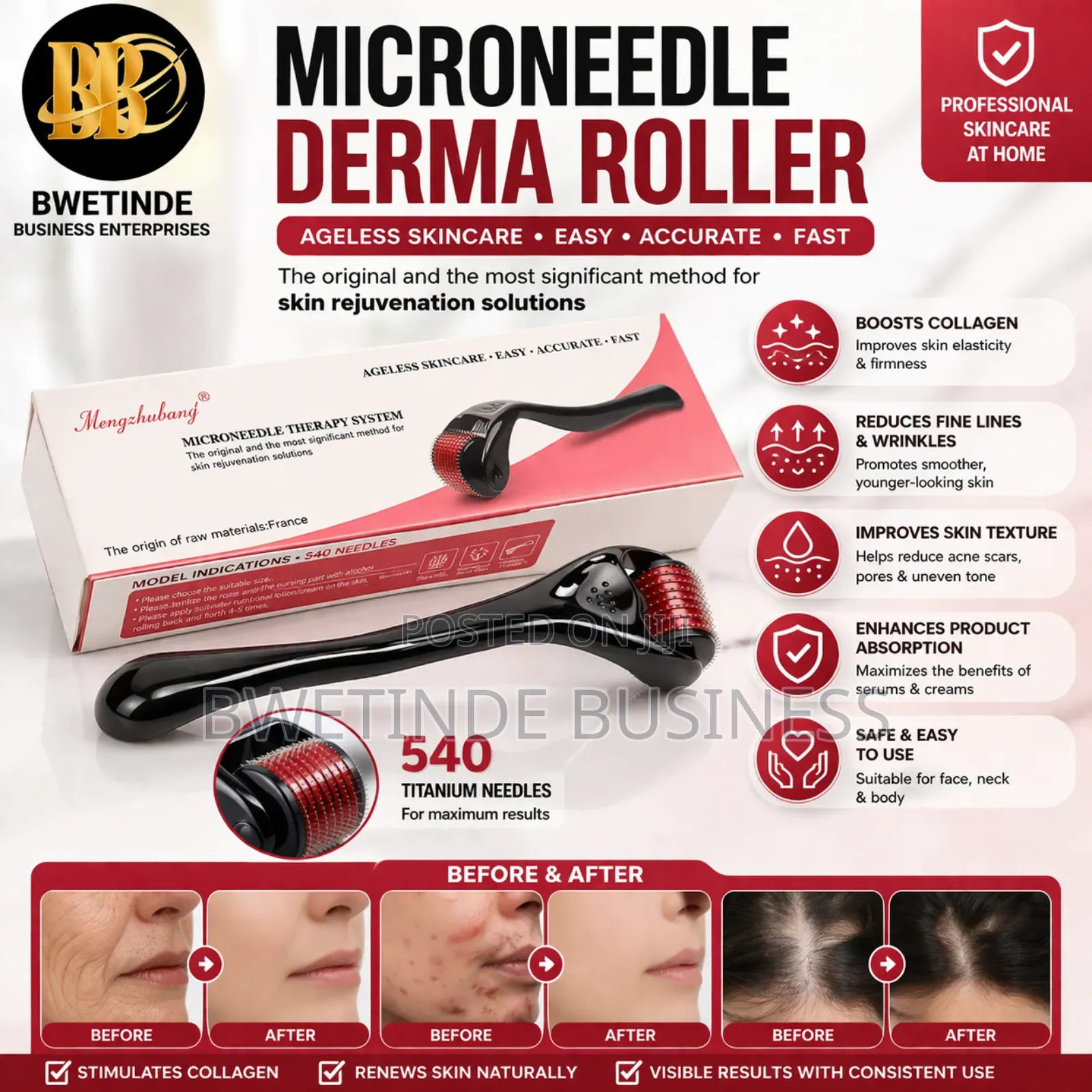 Derma Roller 540 Needles – Beard, Hair Growth Skin Care Tool