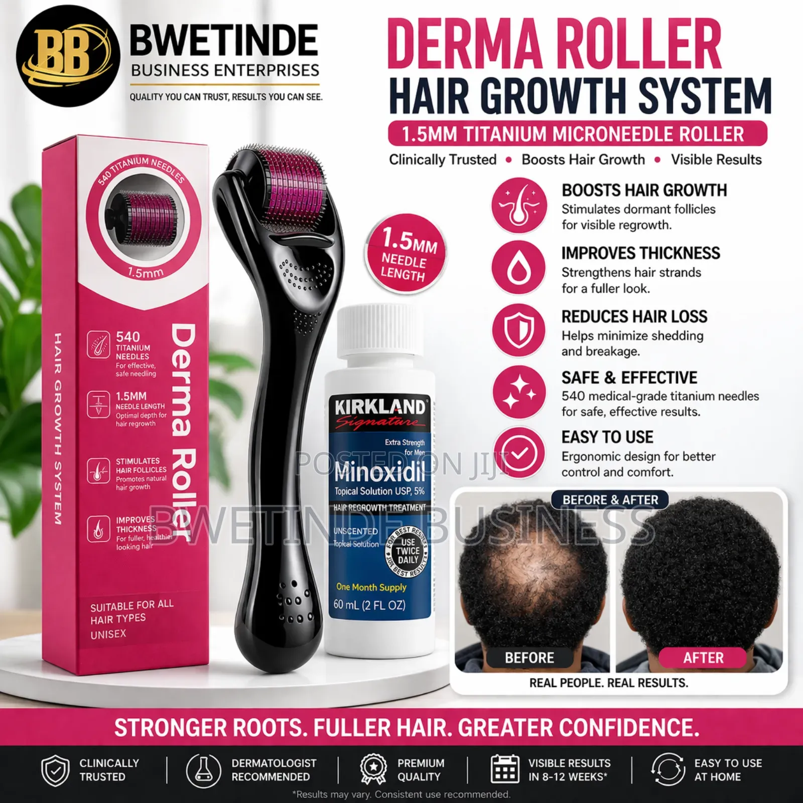 Hair /Beards Fast Growth Solution for Treating Baldness