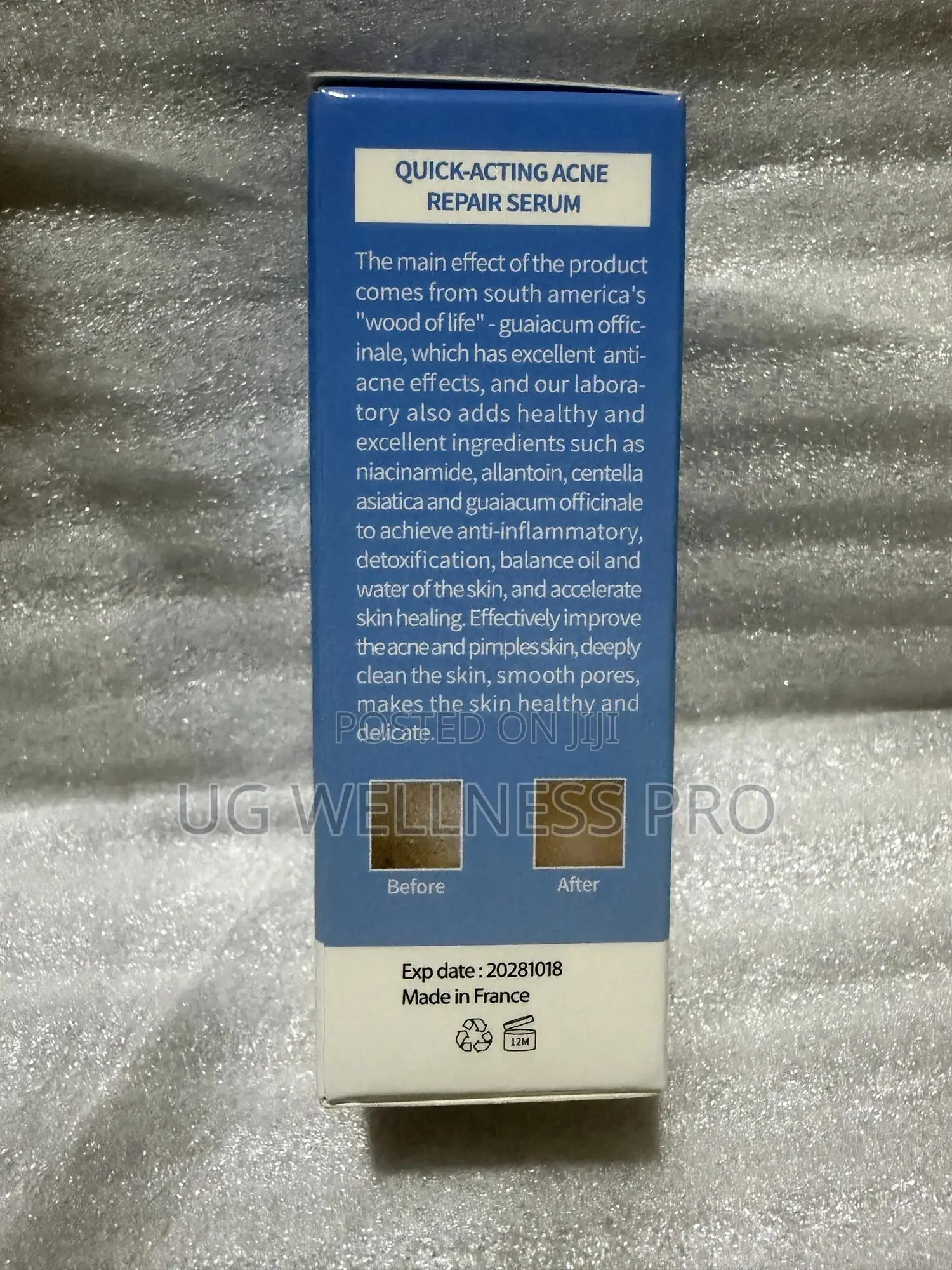 U Beauty Quick-Acting Acne Repair Serum 15mls