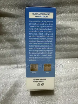 U Beauty Quick-Acting Acne Repair Serum 15mls