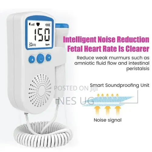 Fetal Doppler Portable Handheld Baby Heart Rate Monitor - White