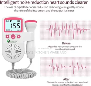 Fetal Doppler Heart Beat Monitor – Fetal Movement Count