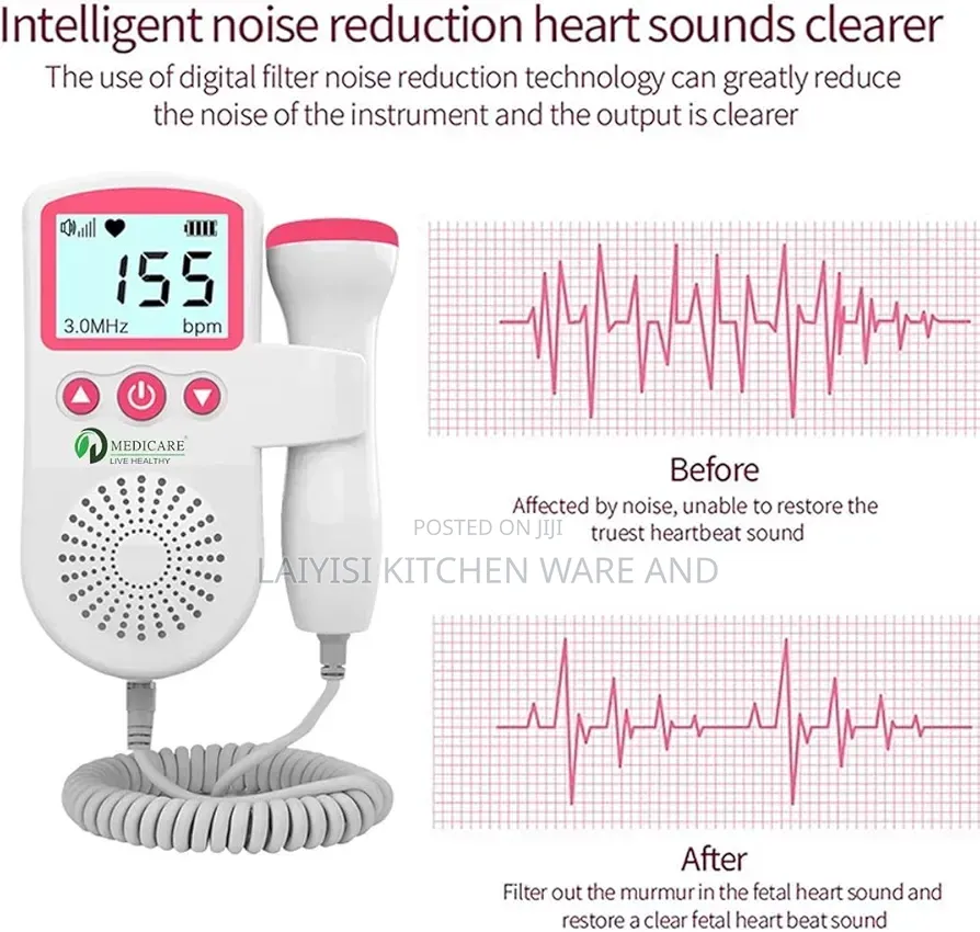 Fetal Doppler Heart Beat Monitor – Fetal Movement Count