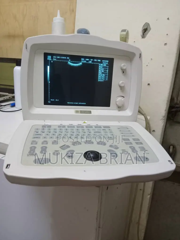 Ultrasound Scan Machine