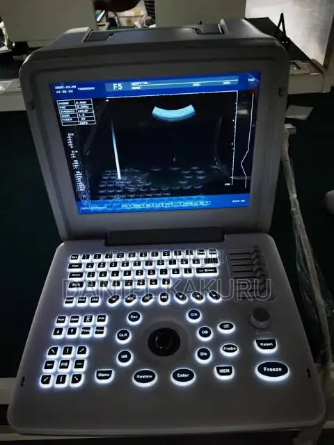 Ultrasound Scan Machine