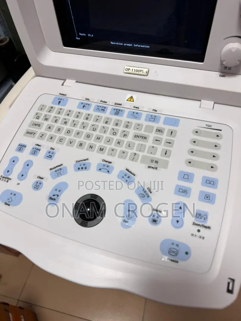 Mindray Dp 1100 Black and White Ultrasound