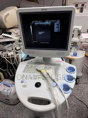 Dp 7700 Ultrasound B/W Cart