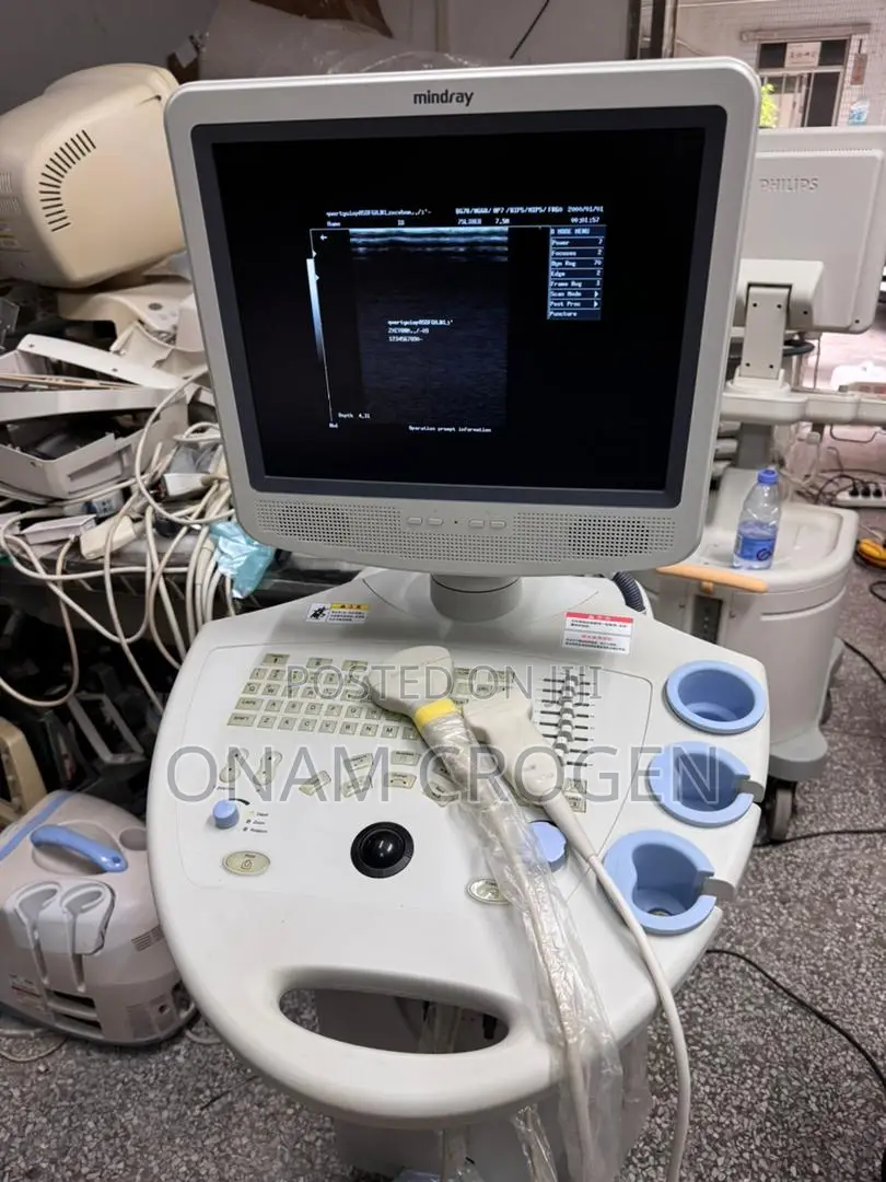 Dp 7700 Ultrasound B/W Cart