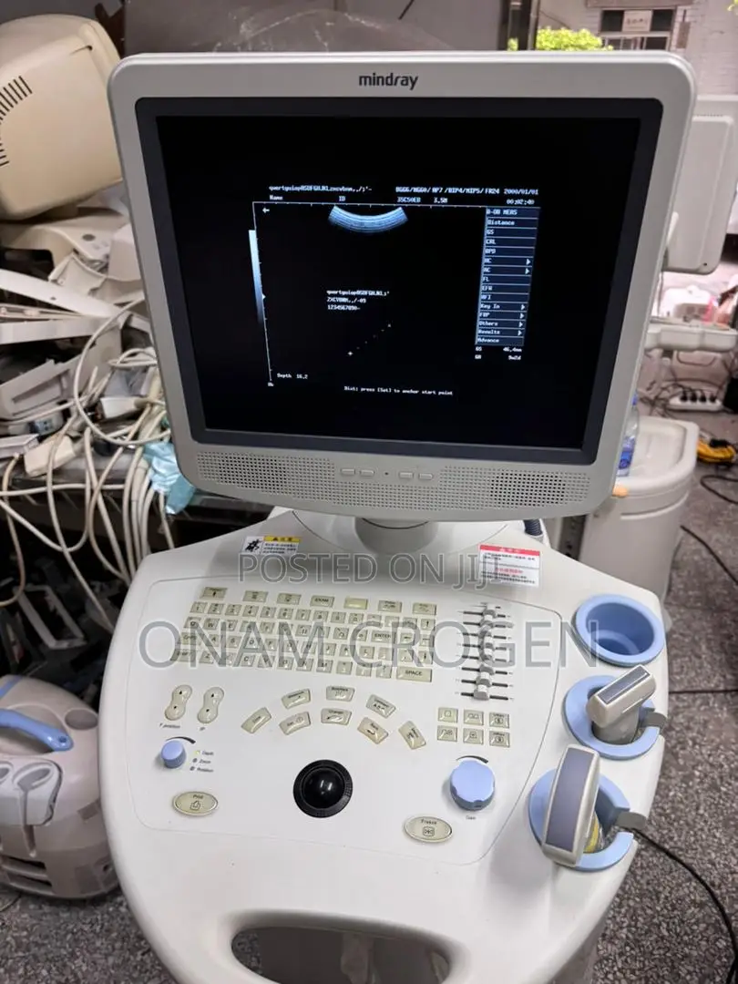 Dp 7700 Ultrasound B/W Cart