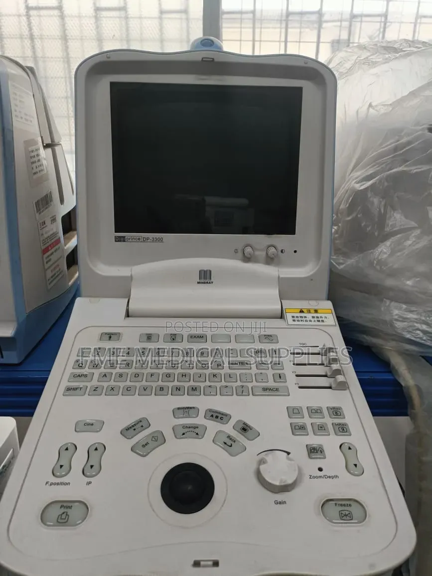 Dp3300 Ultrasound Scan