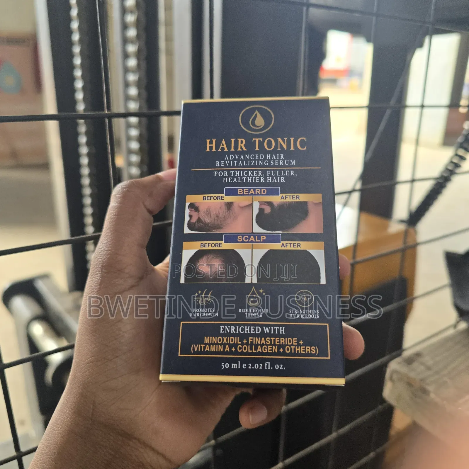 Minoxidil 15% Finasteride Hair Loss Treatment