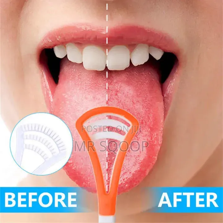 Plastic Tongue Cleaner | Fresh Breath Oral Hygiene Tool