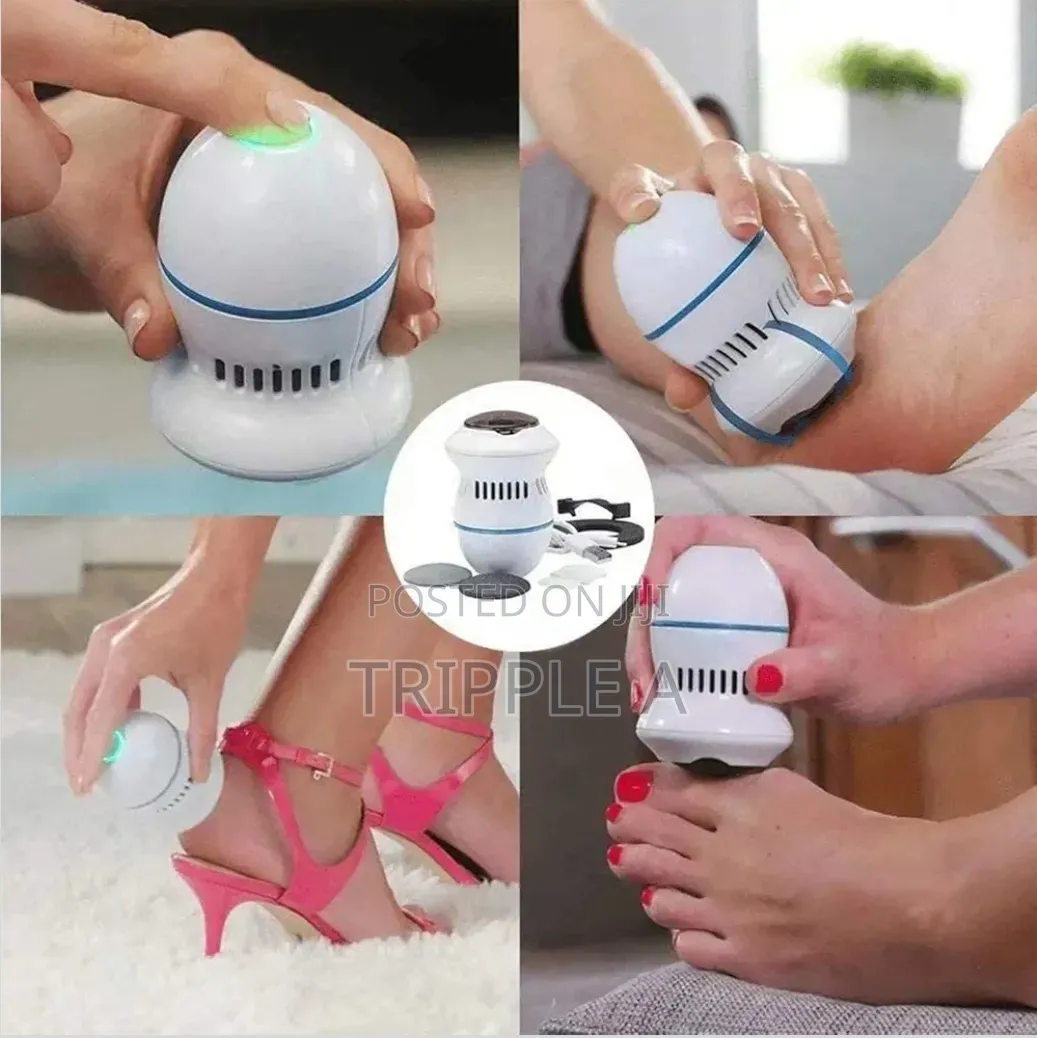 Vaccum Foot Callus Remover