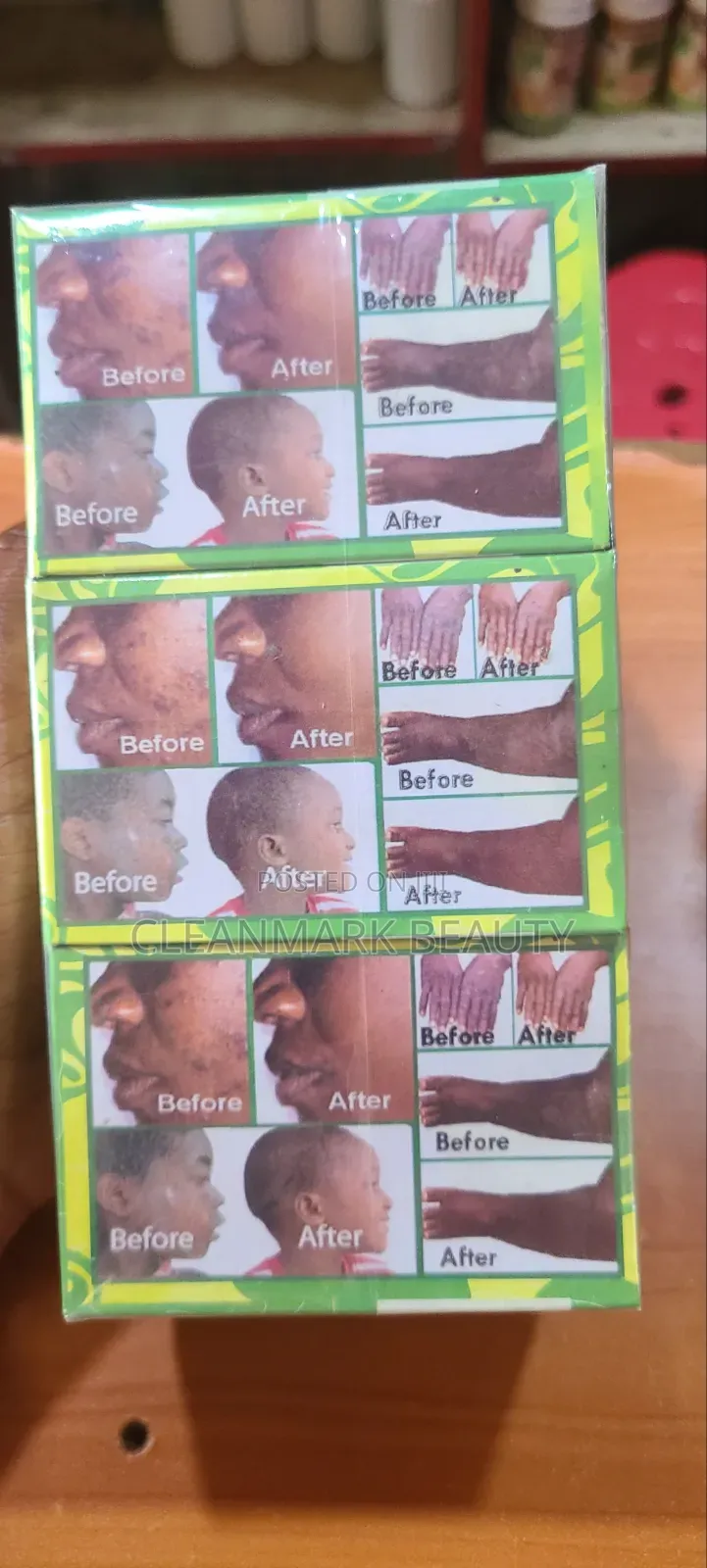 Makeda Herbal Soap (Skim Rush ,Burns