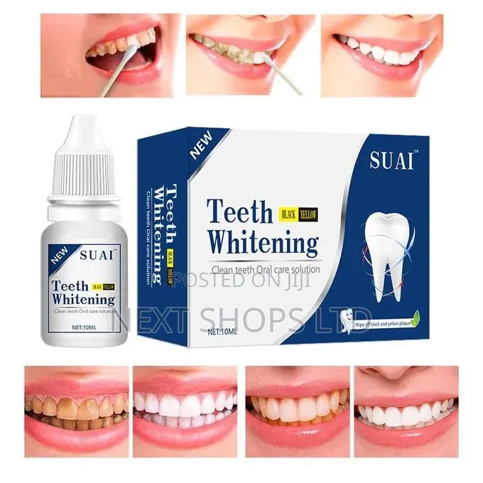 Teeth Whitening Solution/Teeth Whitening Solution/Tooth Cleaning