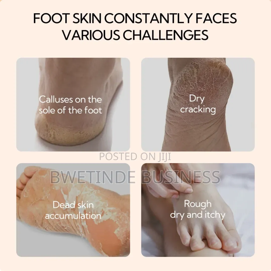 Lanbena Foot Repair Cream
