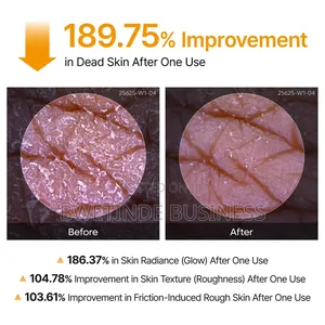 Dr.Melaxin Peel Shot Kojic Acid Turmeric Body Exfoliator Spray