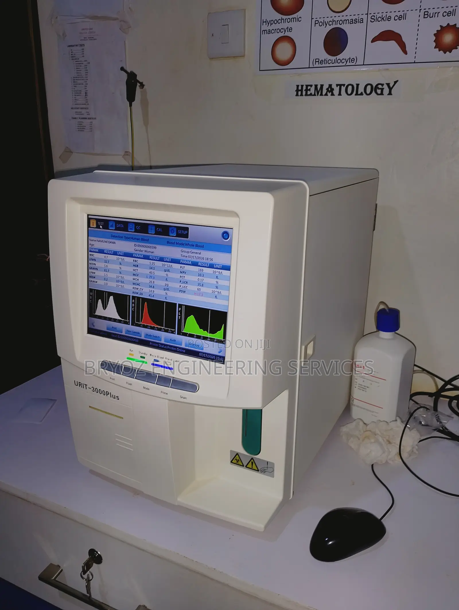 Repair and Service of Hematology Analyzers Machine