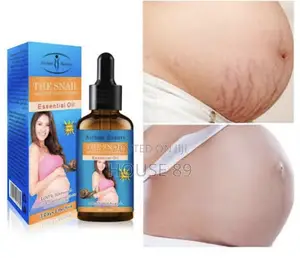 The Snail Essential Oil - Removes Stretch Marks