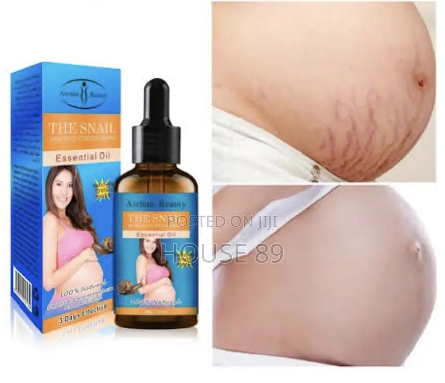 The Snail Essential Oil - Removes Stretch Marks