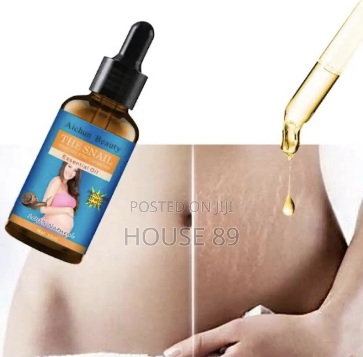 The Snail Essential Oil - Removes Stretch Marks