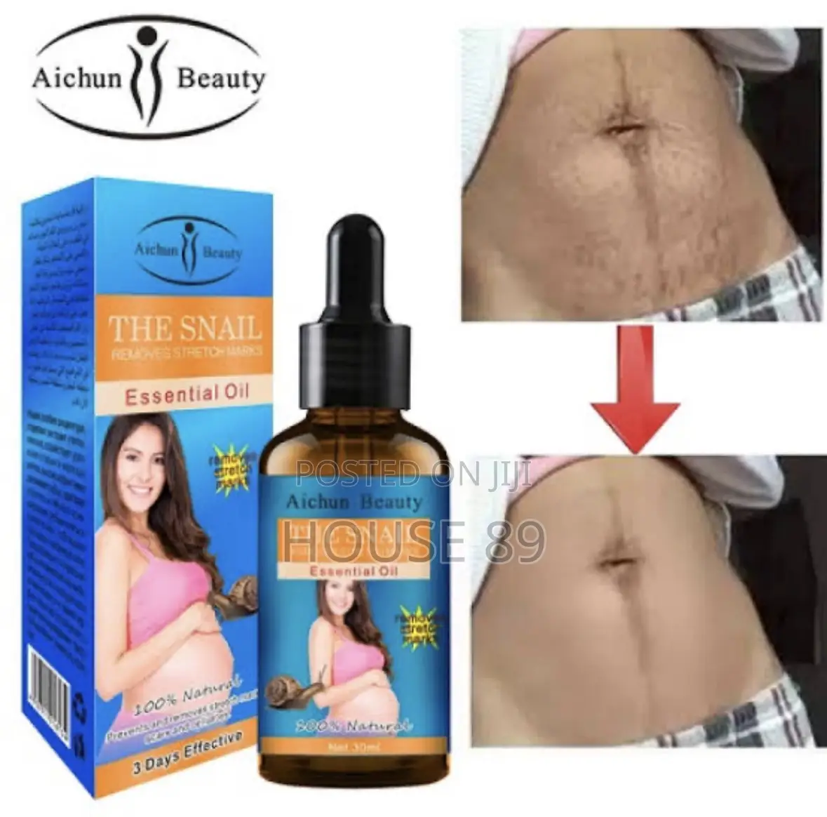 The Snail Essential Oil - Removes Stretch Marks