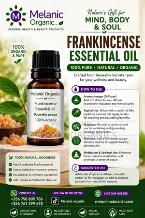 Frankincense Essential Oil 30ml