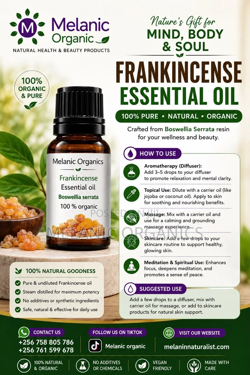 Frankincense Essential Oil 30ml