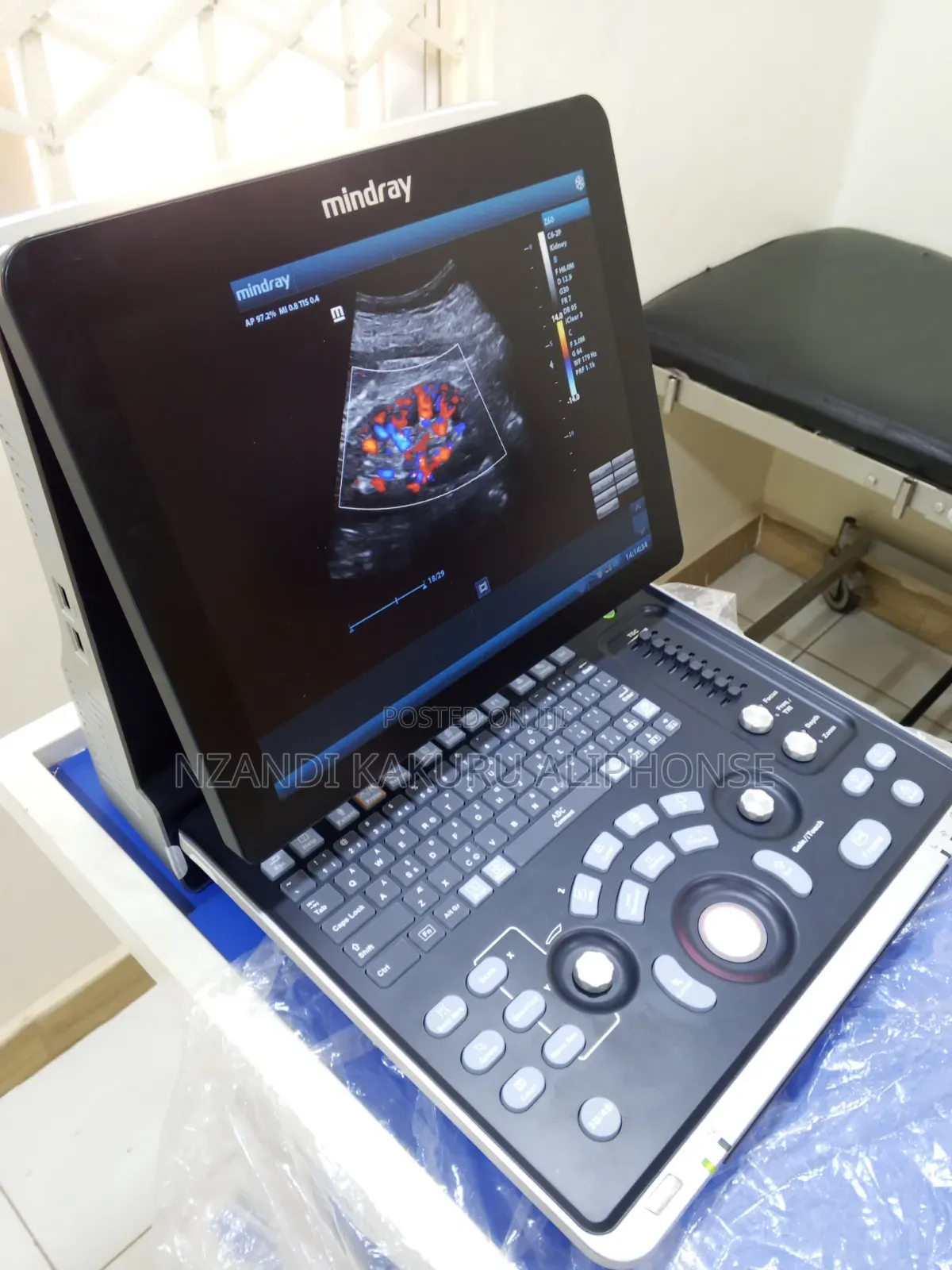 Brand New Mindray Scan, Colored 3D 4D Z60 on Promotion 20 Monthly Pay
