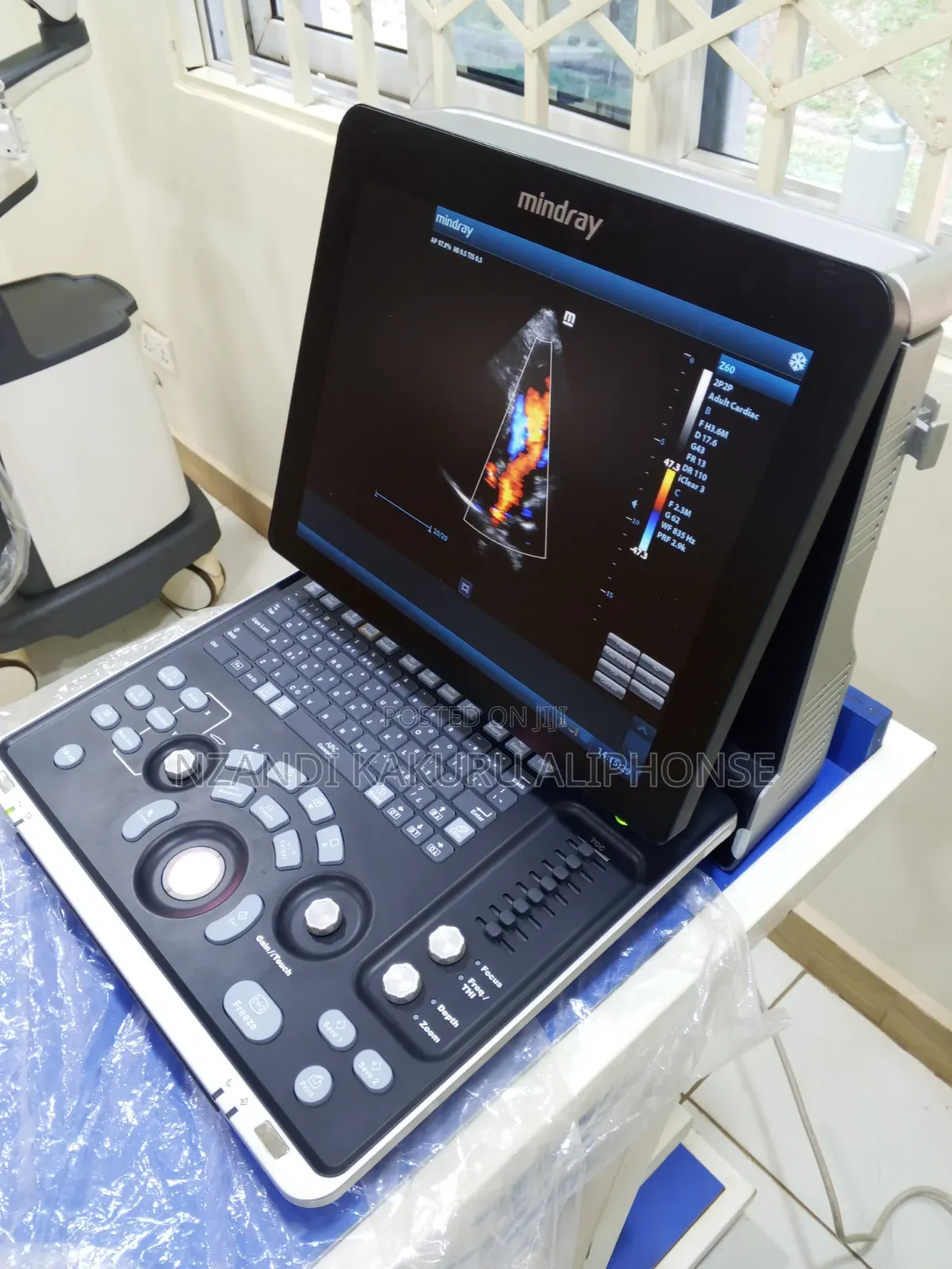 Brand New Mindray Scan, Colored 3D 4D Z60 on Promotion 20 Monthly Pay