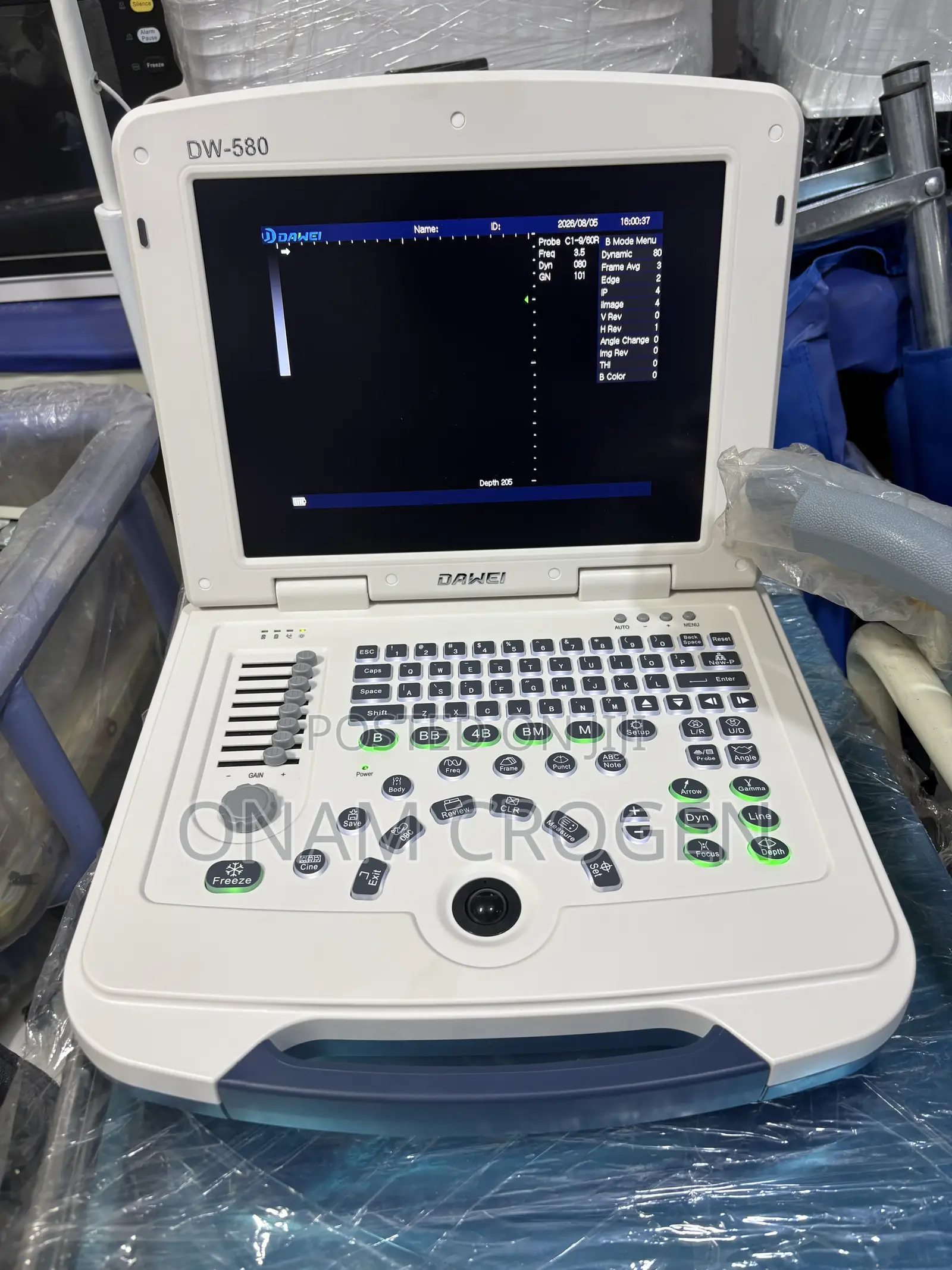 Dawei Ultrasound Qw 580