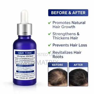 Hair Growth Tonic Fast Beard Hair Regrowth Treatment