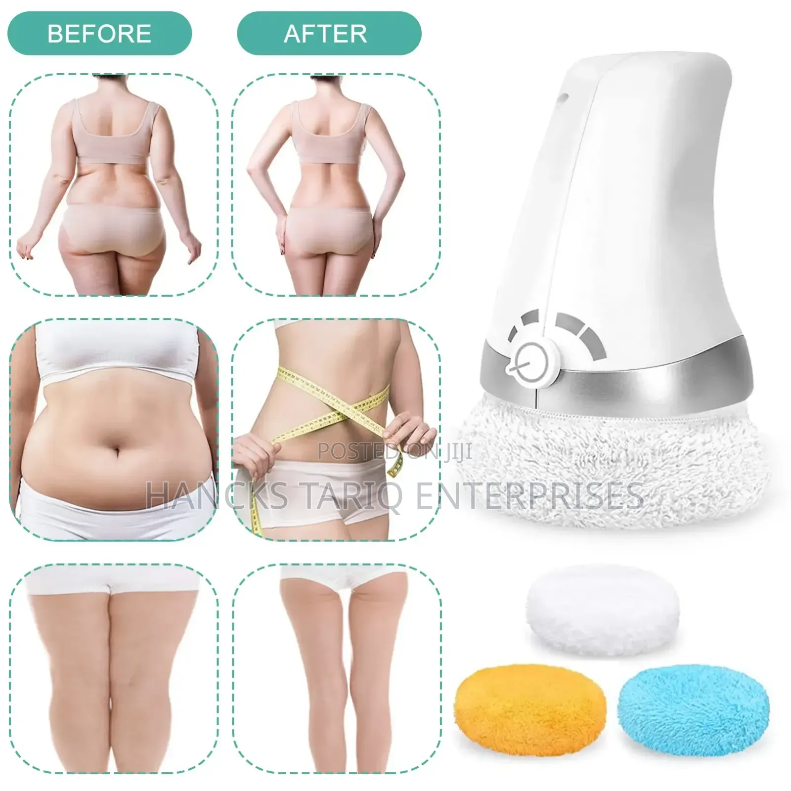 Electric Body Relaxer and Anti-Cellulite Body Care System
